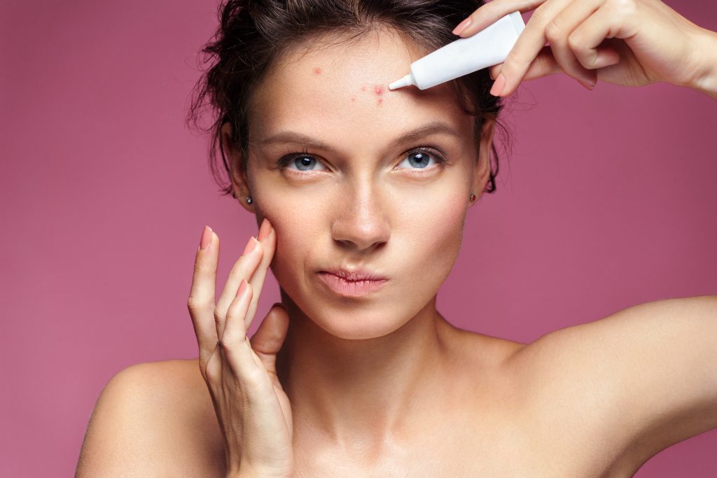 a woman putting cream on her pimples