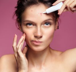 a woman putting cream on her pimples